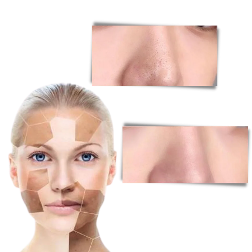 ClearSkin™ Libera tu piel de impurezas y revela su brillo natural.