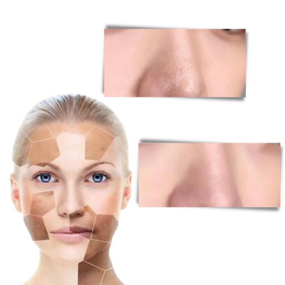 ClearSkin™ Libera tu piel de impurezas y revela su brillo natural.